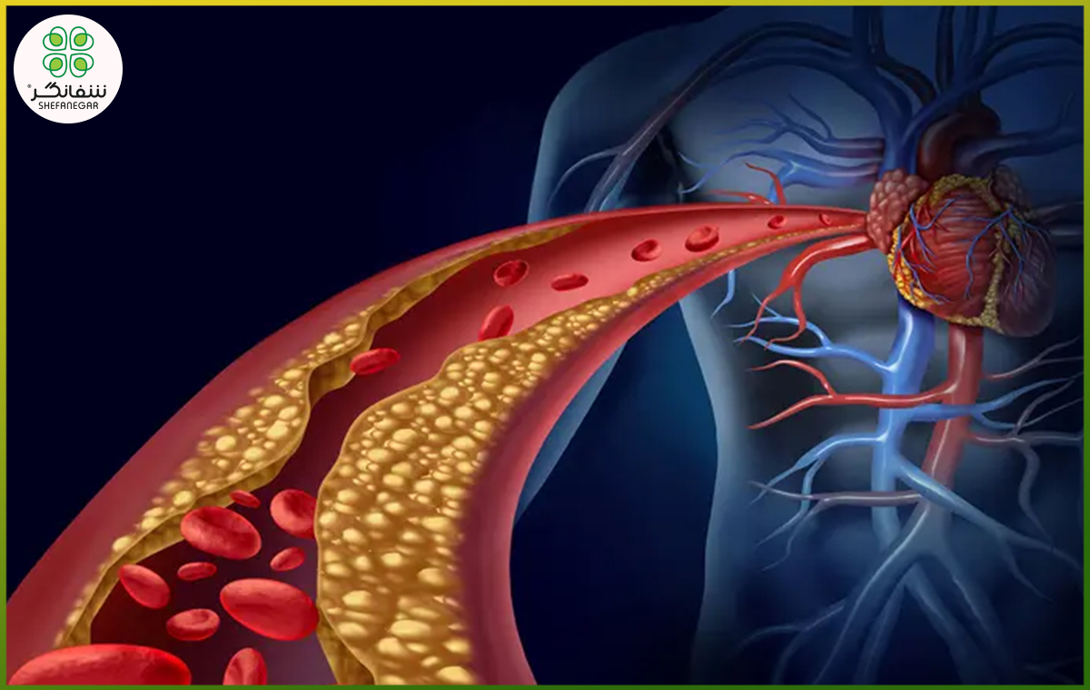 برای کاهش سریع چربی خون چه بخوریم؟ معرفی بهترین غذاها و نوشیدنی‌ها